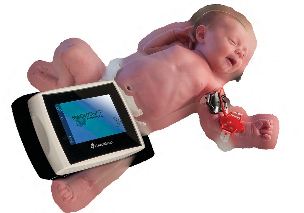 Macroduct® Advanced